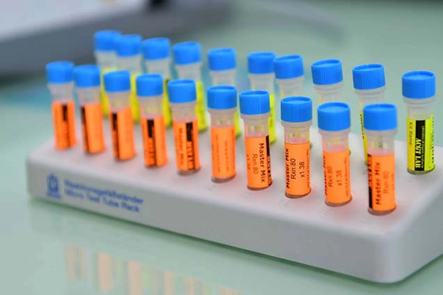 Сроки разработки казахстанской вакцины Qazcovid-in – смотрите онлайн-брифинг 